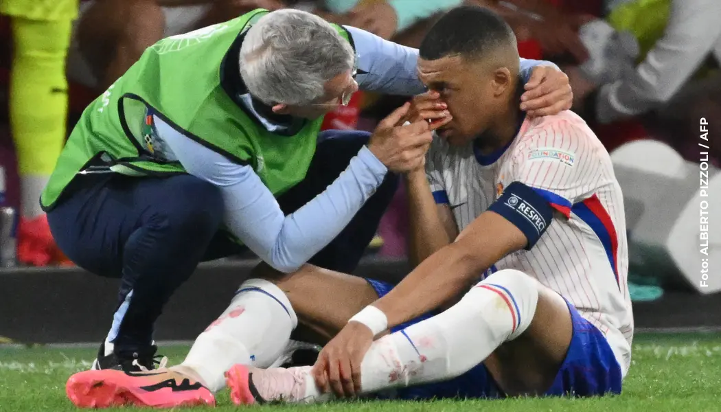 Kylian Mbappé tuvo un duro golpe en el debut de Francia en la Eurocopa.