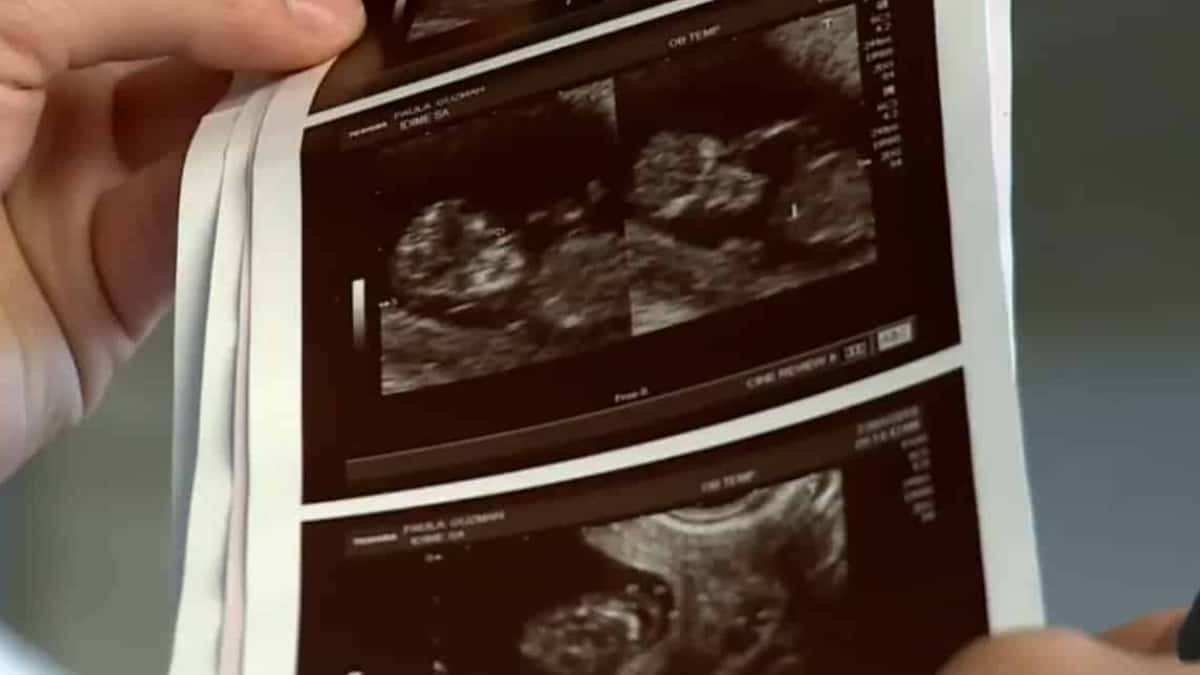 Corte Suprema de Estados Unidos anularía derecho al aborto