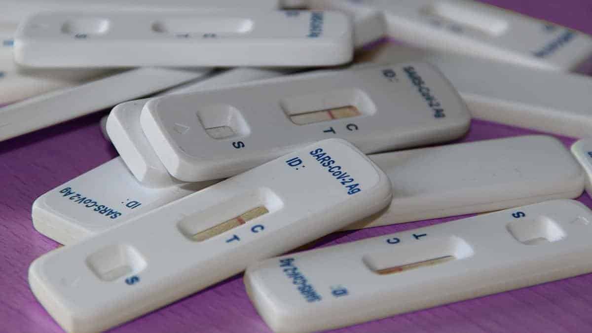 Autorizan uso de pruebas 'caseras' de antígenos covid en Colombia