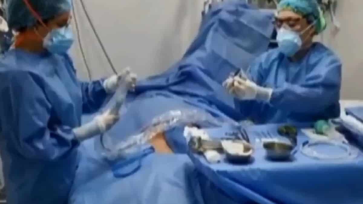 Coronavirus en Colombia: ¿Cómo es el proceso de terapia ECMO?