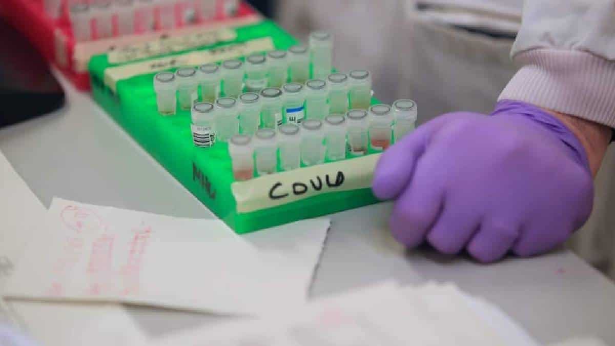 Covid dejó más de 9.700 nuevos contagios y 200 muertes el 8 de febrero