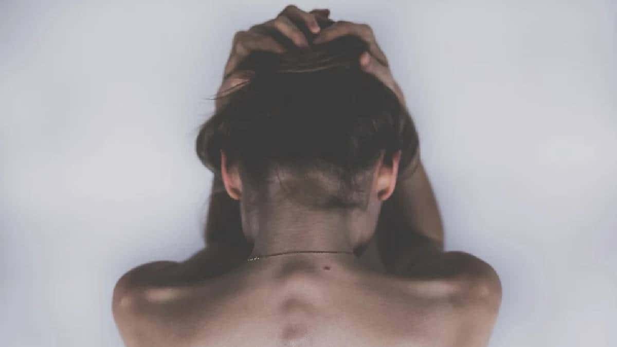 Hombre le arrancó el cuero cabelludo a su expareja