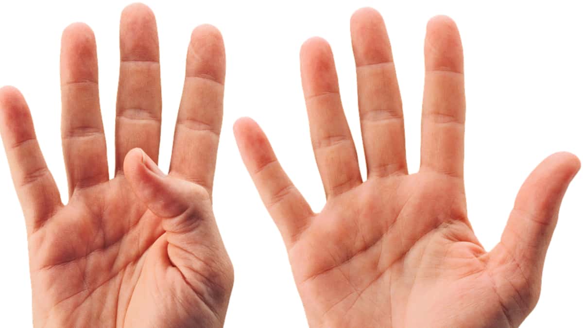 Imagen de referencia - Pixabay