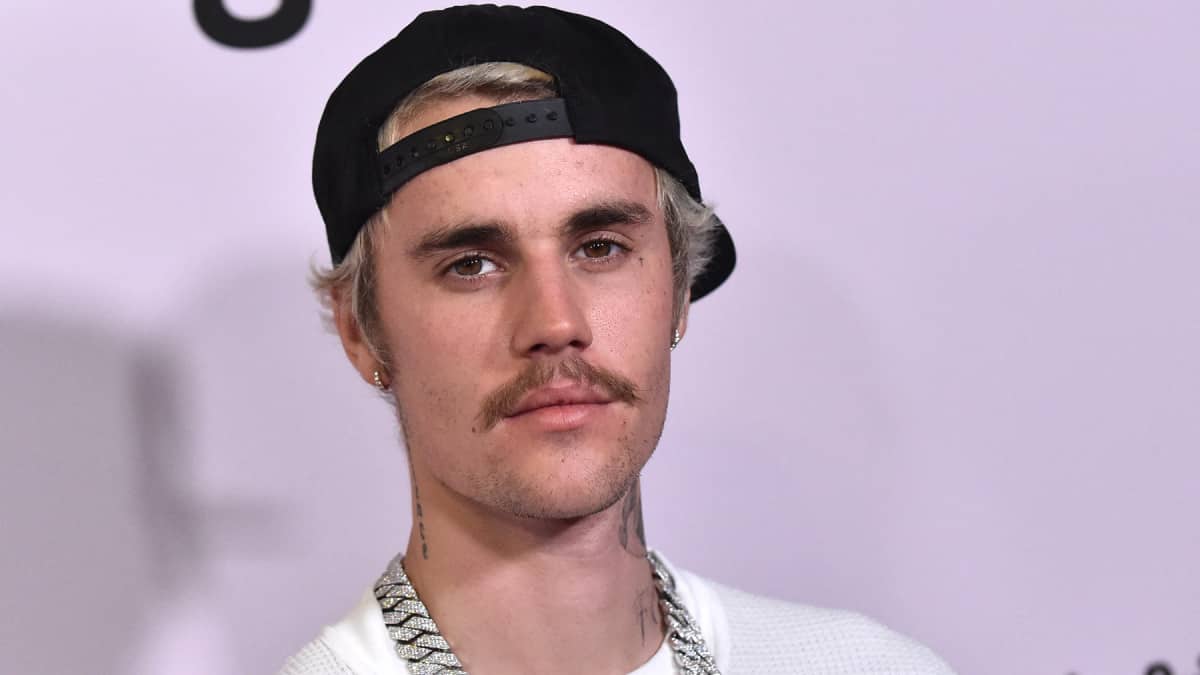 El síndrome que paralizó el rostro de Justin Bieber