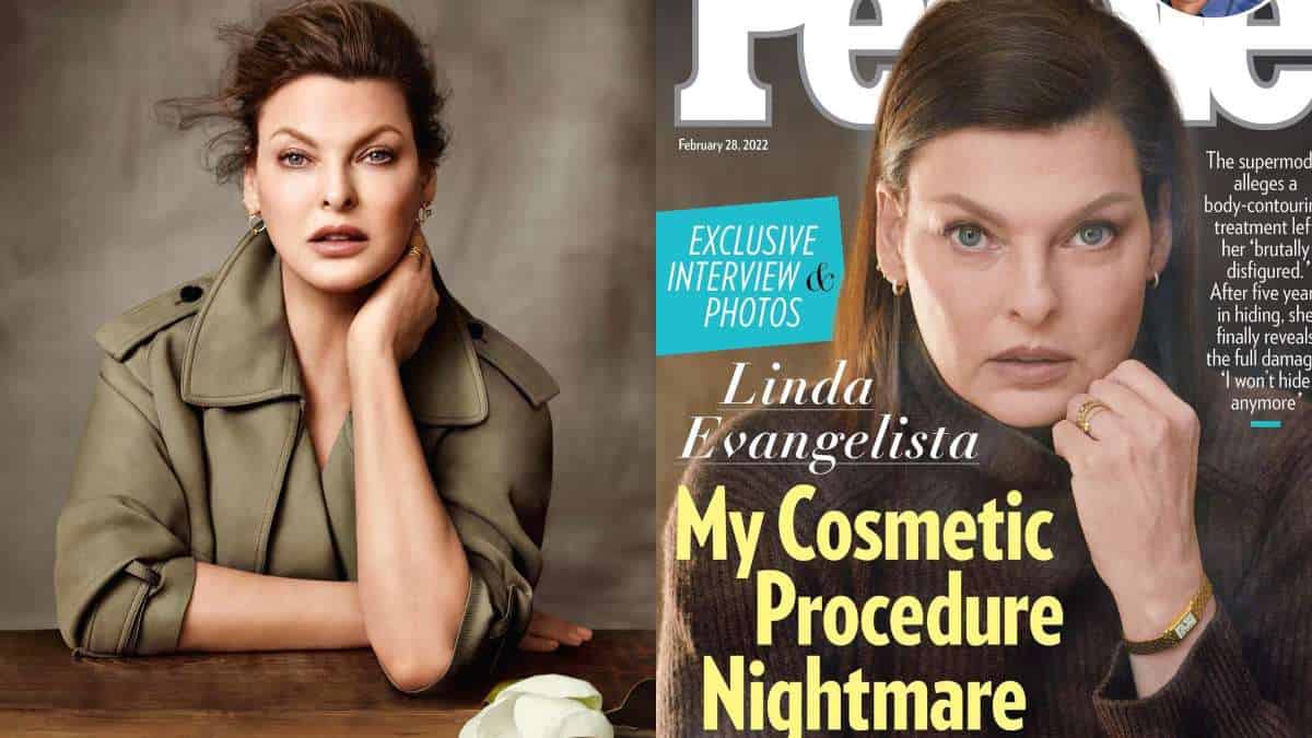 Linda Evangelista: el procedimiento estético que la retiró de las pasarelas