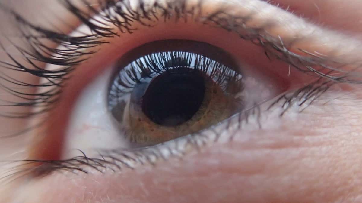 ¿Qué es el glaucoma y cómo se puede prevenir a tiempo?