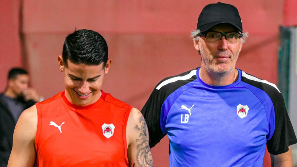 James y Laurent Blanc