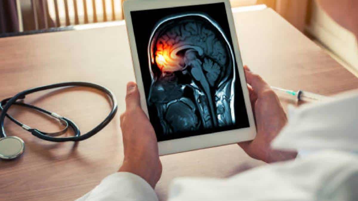 La meningitis bacteriana mata a una de cada diez personas infectadas