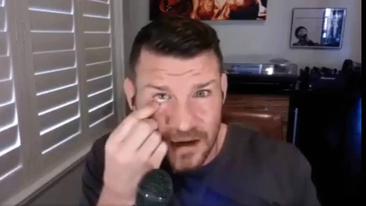 Michael Bisping, luchador UFC, se quitó su ojo de cristal en entrevista