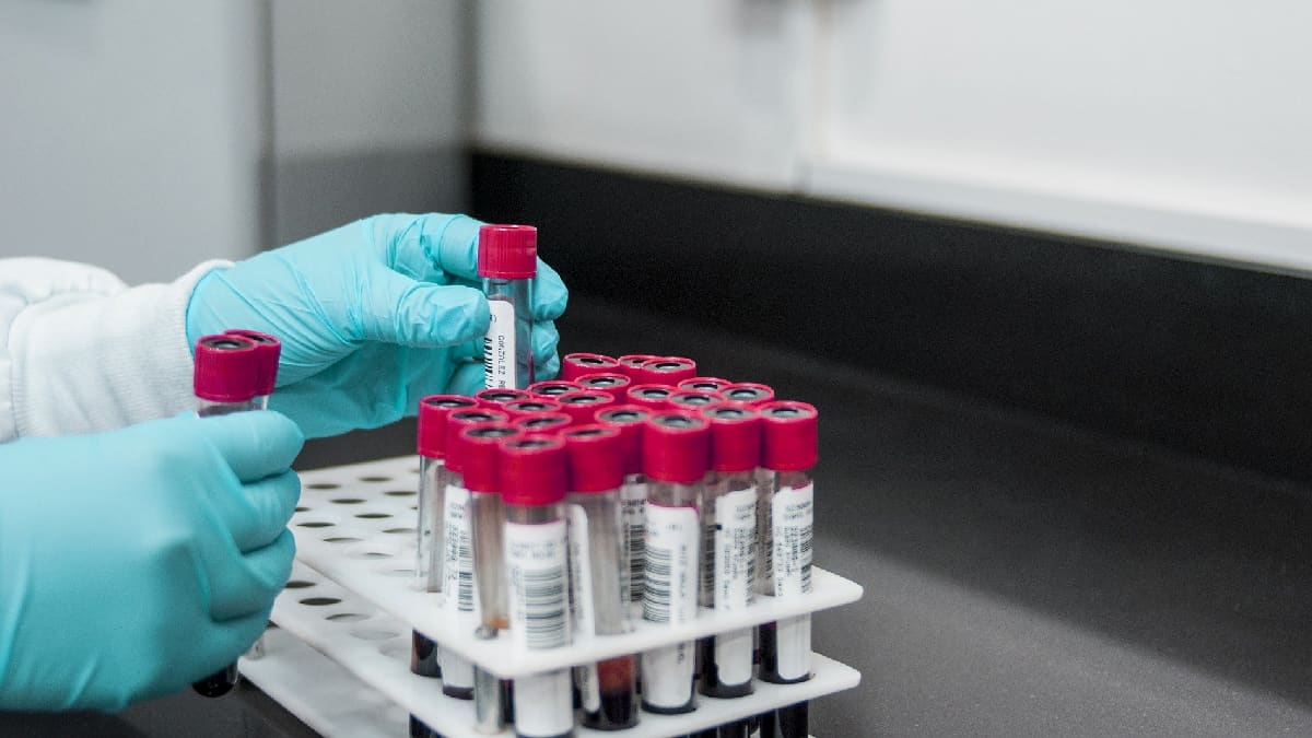 Laboratorio indio SII reanuda exportaciones de vacunas anticovid a los países más pobres