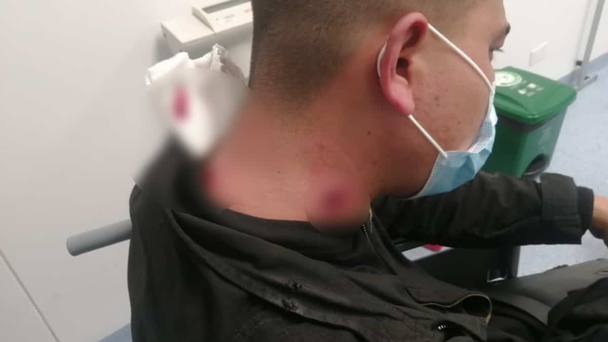 Policía herido en el Valle del Cauca.