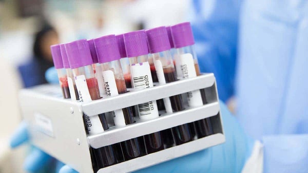 Alisadores de cabello aumentarían las probabilidades de padecer este tipo de cáncer, según estudio Alisadores de cabello aumentarían las probabilidades de padecer este tipo de cáncer, según estudio