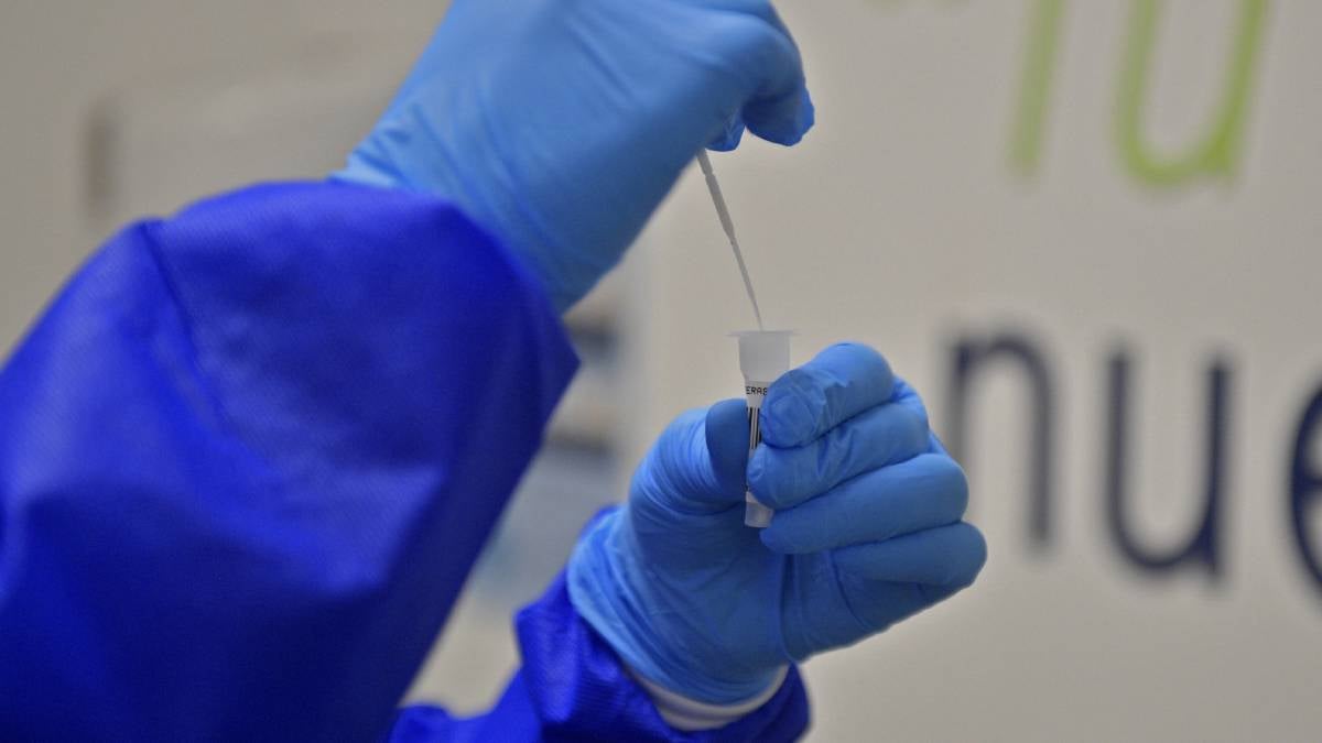 Pruebas covid gratis en Bogotá: consulte aquí los puntos