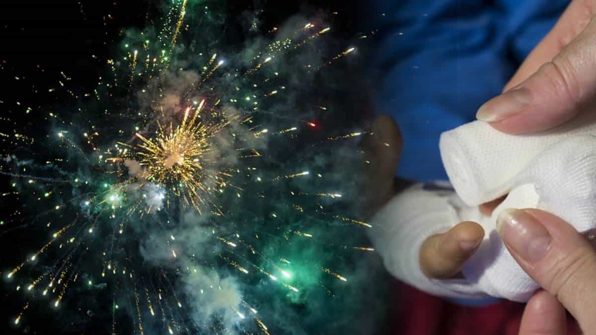 Casos de quemados con pólvora en Colombia