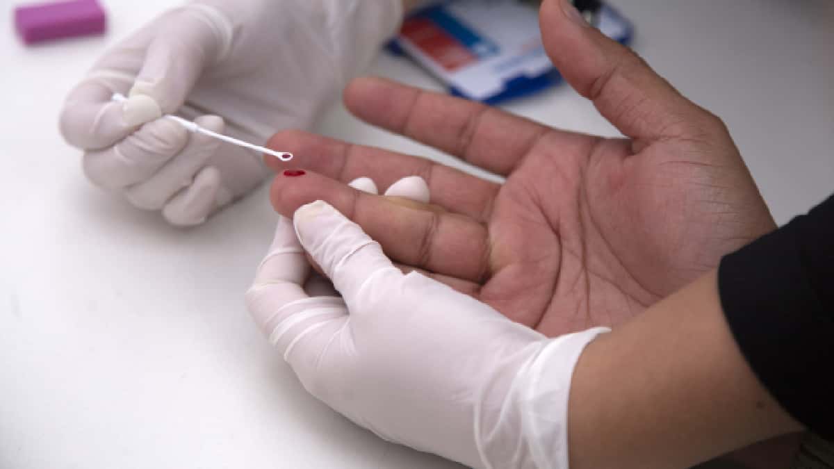 El sida avanza en el este de Europa, eclipsado por el covid