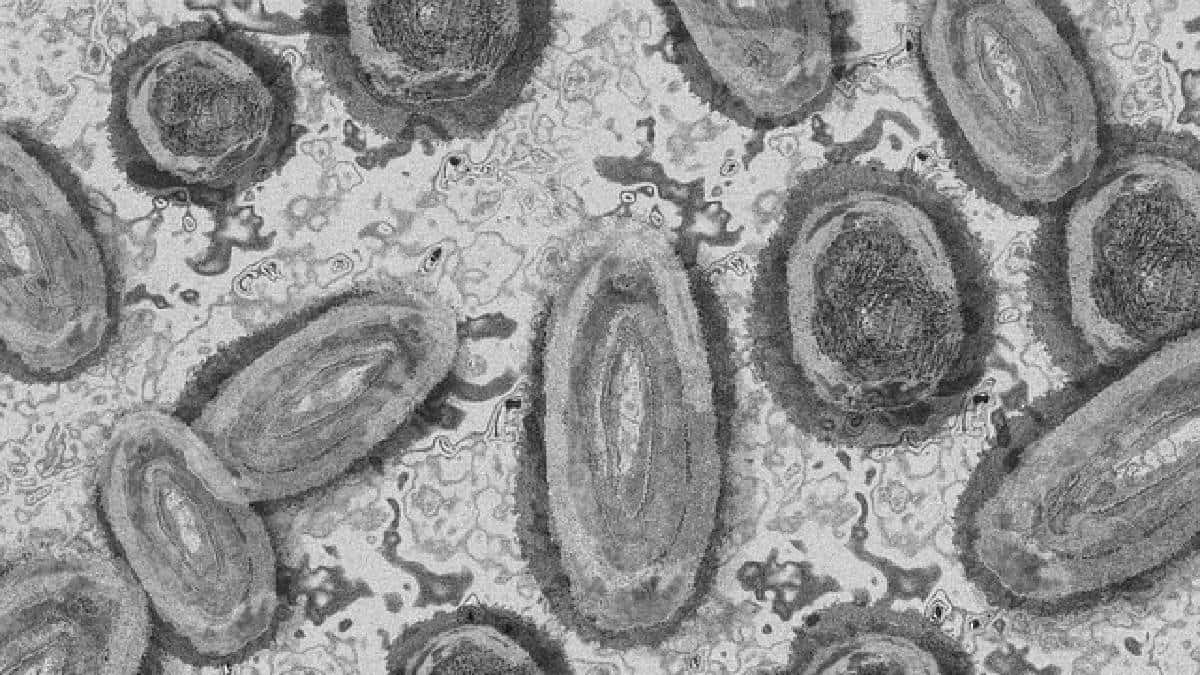 Virus del mono /Foto: Pixabay Virus del mono