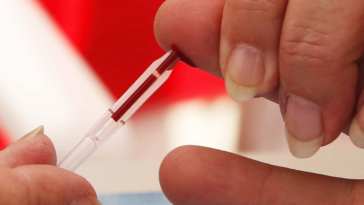 VIH: la lucha en África ralentizada por el covid-19