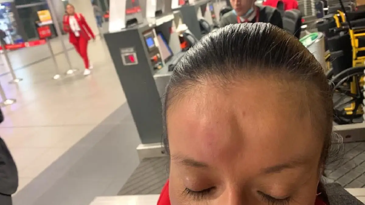 Pasajera le pegó cabezazo a trabajadora de El Dorado