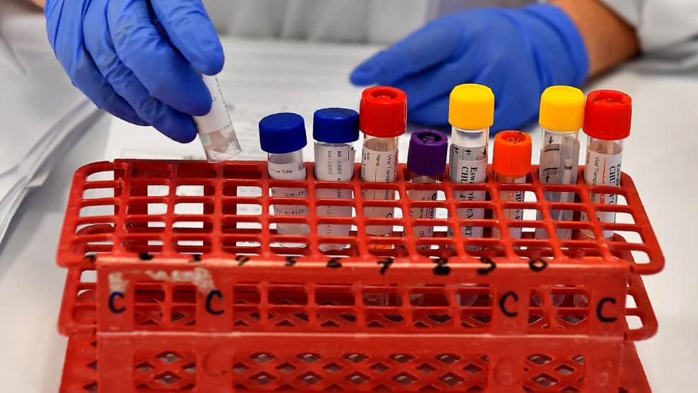 Anticuerpos monoclonales, una esperanza capaz de combatir el coronavirus