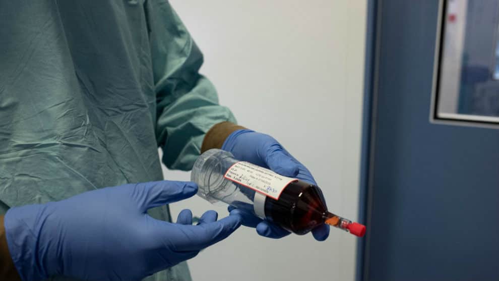 El 26% de los fallecimientos en el mundo es por cáncer