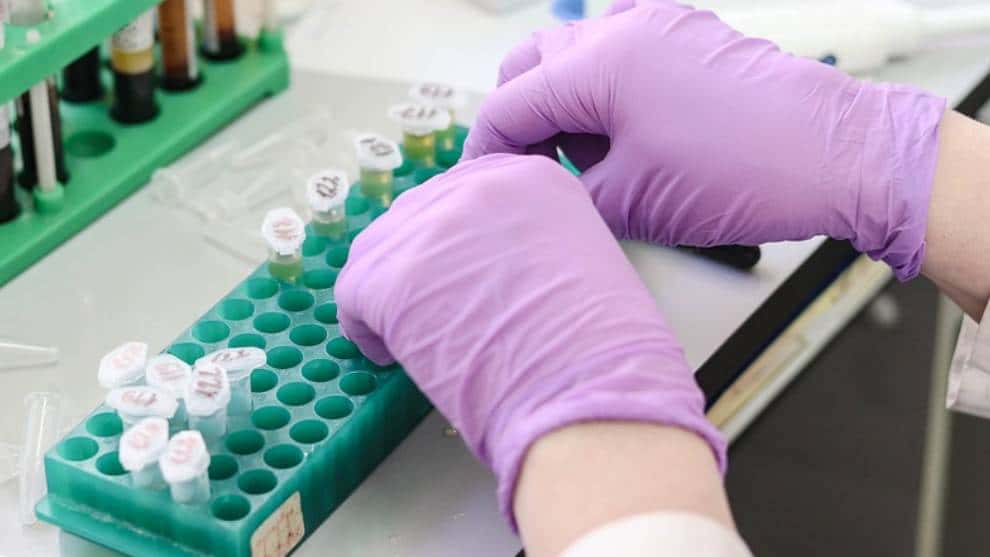 Más de 3.800 nuevos casos y 148 muertos: el nuevo registro del covid-19 este lunes