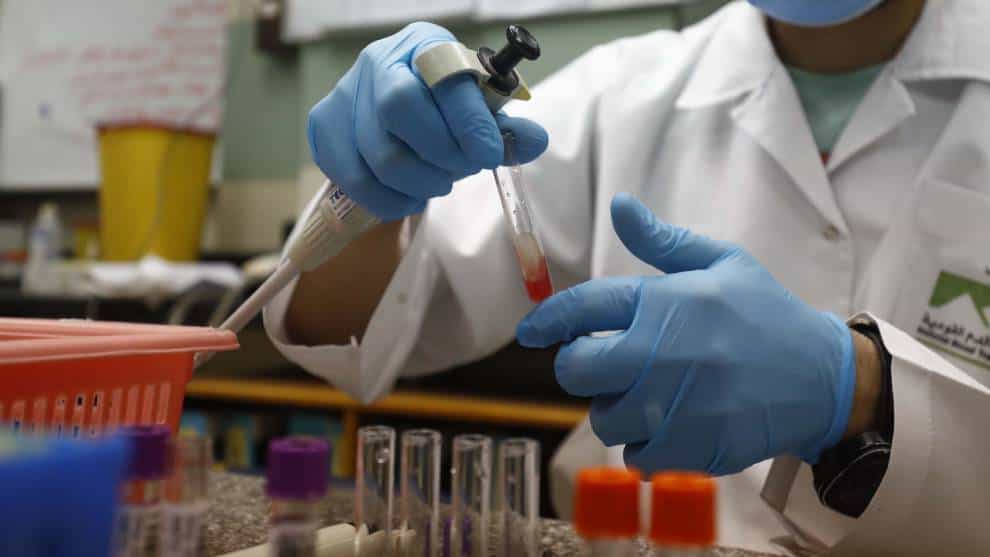 Tratamiento para coronavirus