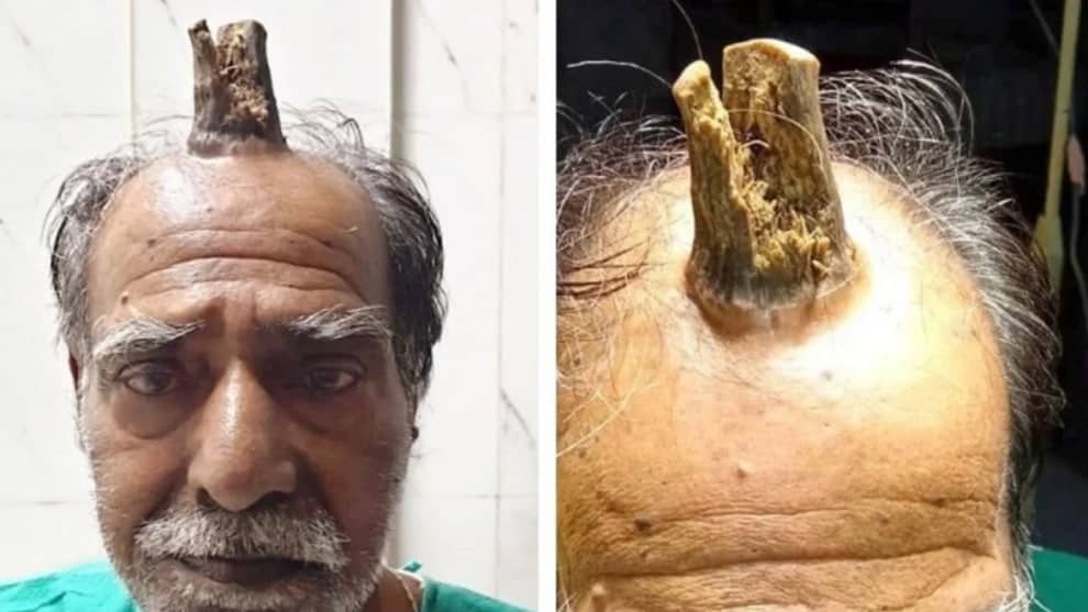 La historia del granjero al que le creció un cuerno en la cabeza