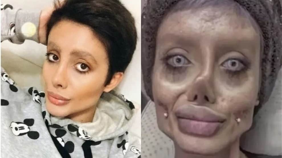 Detienen a mujer iraní que se hizo varias cirugías para parecerse Angelina Jolie