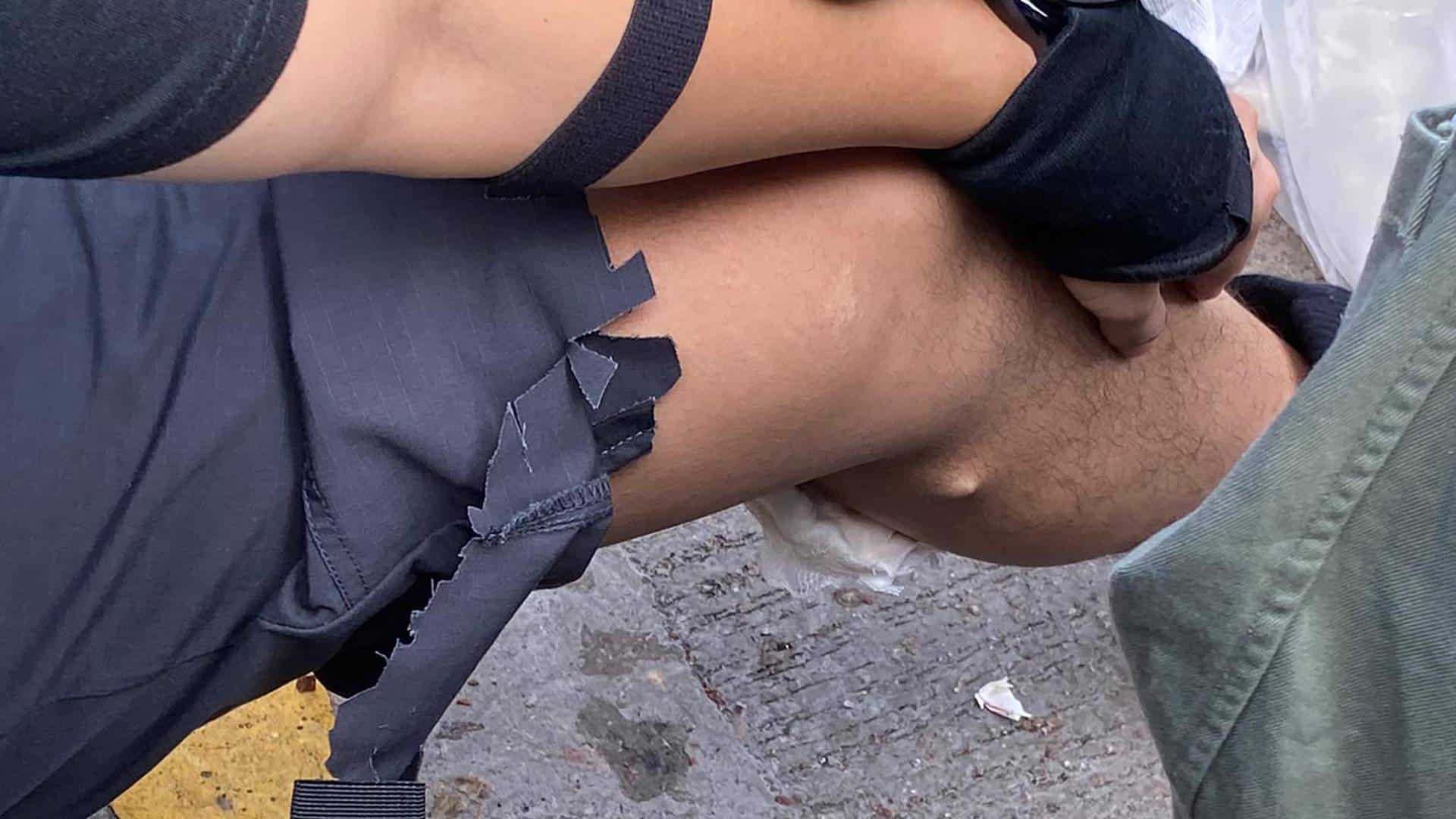 Las fotografías publicadas por la policía muestran una fecha clavada en la pantorrilla. Foto: AFP