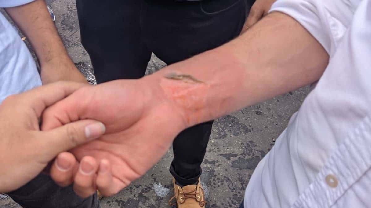 Conductor de BMW estrelló a ladrones en Bogotá - Foto: Noticias RCN