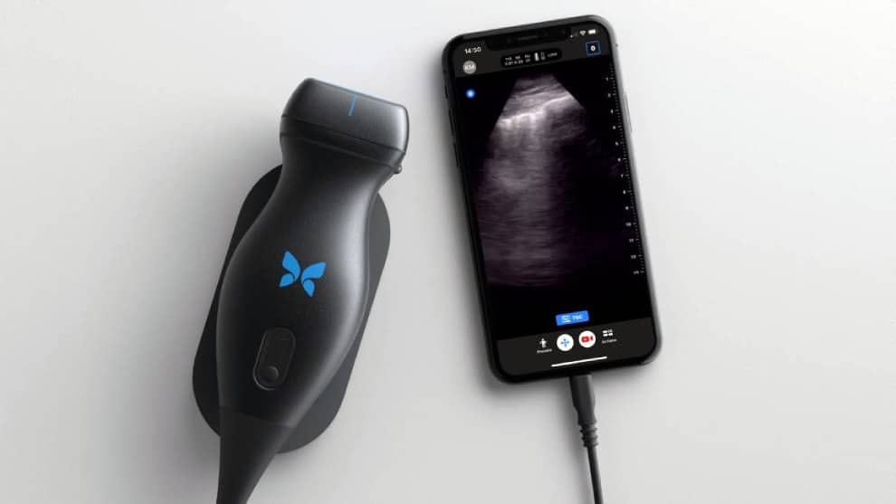 Conozca el gadget que en conjunto con un Iphone podría detectar el coronavirus