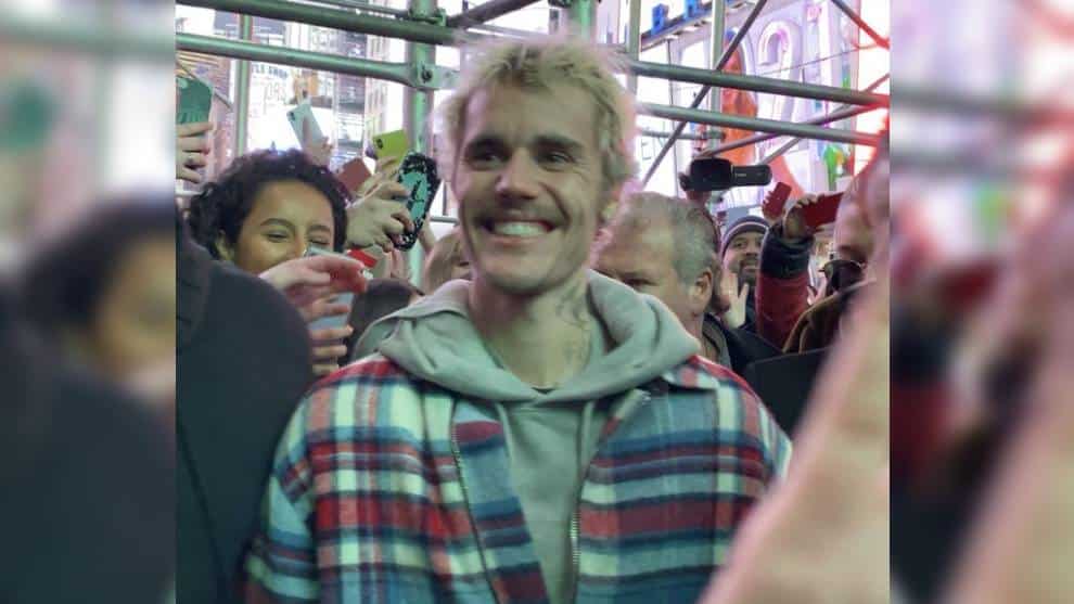 La enfermedad que provocó un drástico cambio en el aspecto de Justin Bieber