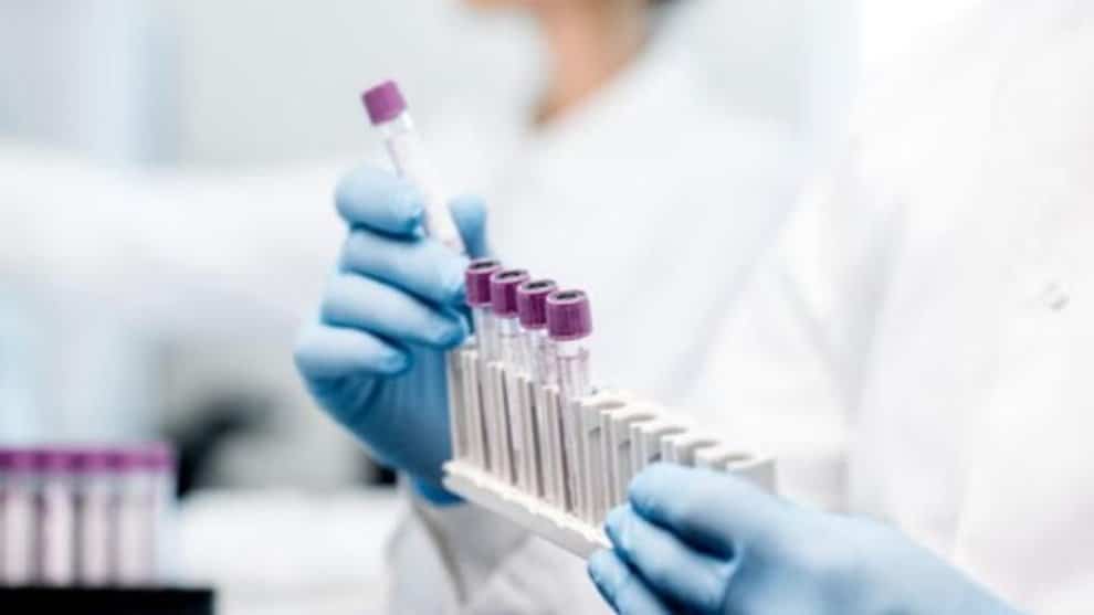 Procuraduría ordenó inspeccionar a las EPS por retrasos en entrega de muestras de covid-19