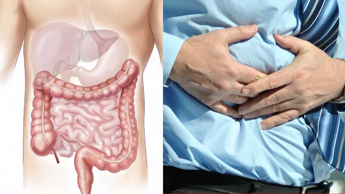Limpieza de colon: mitos y graves consecuencias en el cuerpo