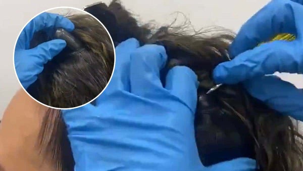 ‘Narcopelucas’, la curiosa modalidad adoptada para transportar droga escondida en el cabello
