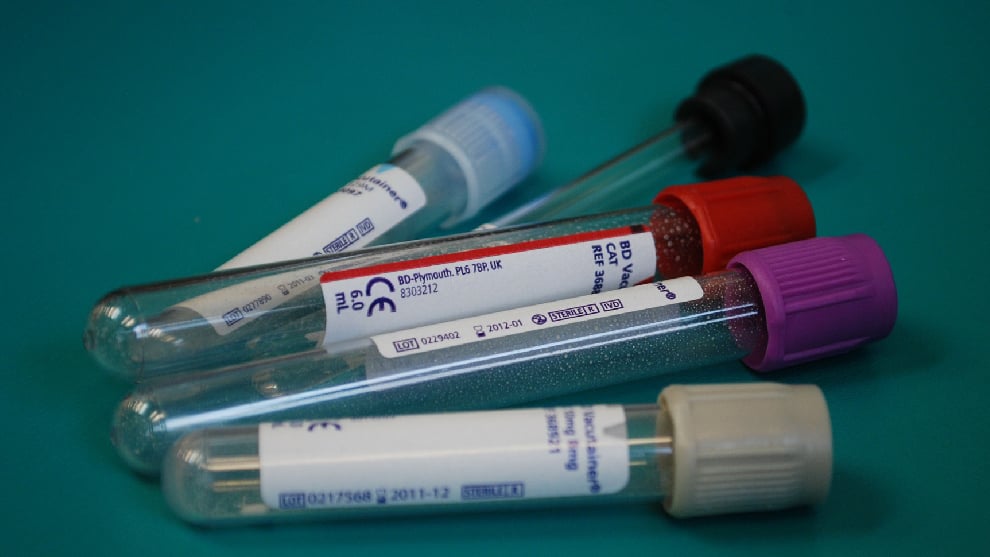Foto: Noticias RCN. Coronavirus salud