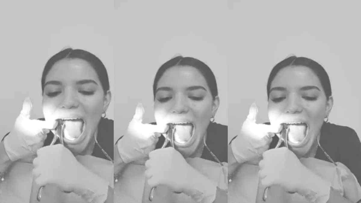 Joven se extrae sus propias cordales