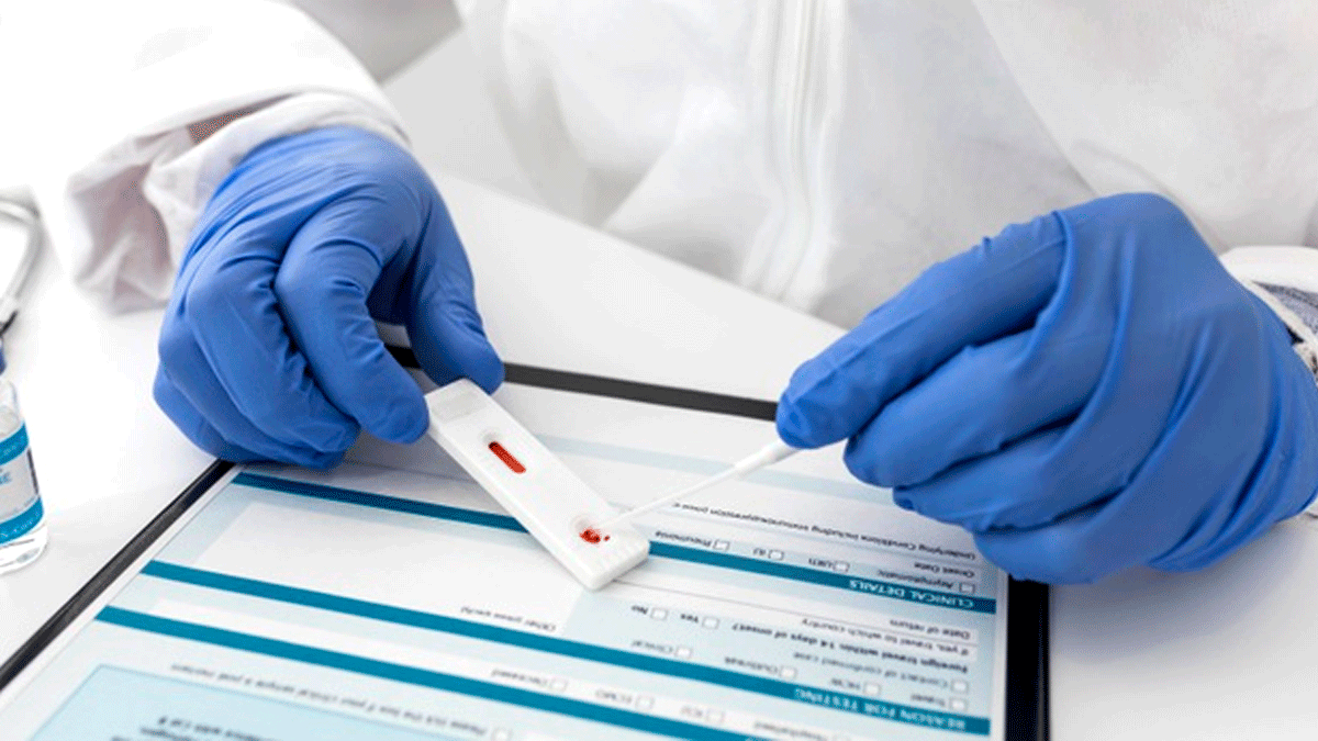 origen del coronavirus será investigado por científicos de la OMS