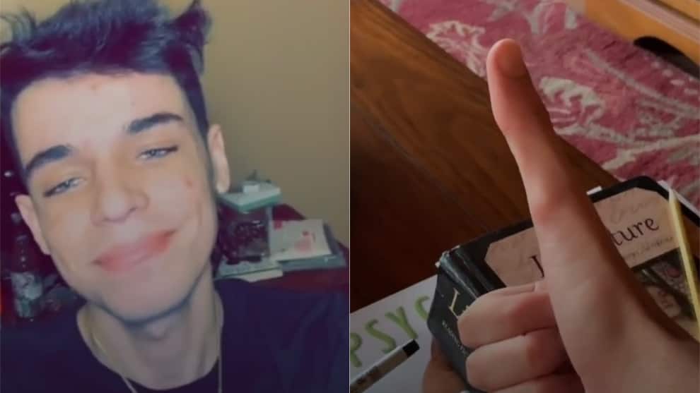 Video: Este es el joven que tiene un dedo más grande de lo normal