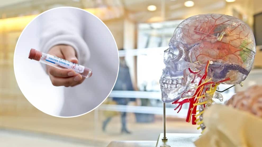 Contagio por coronavirus podría causar problemas cerebrales según estudio