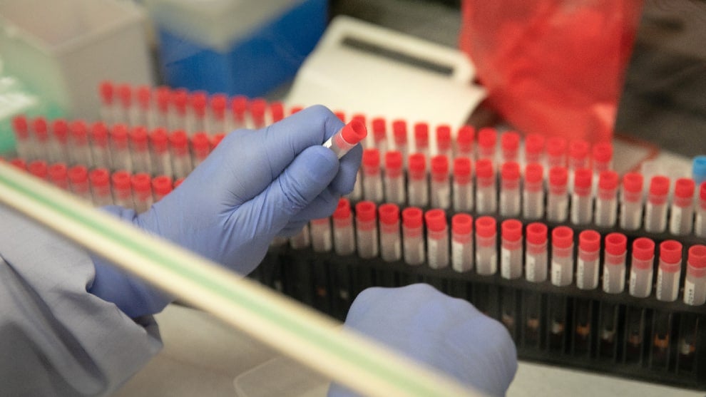 Pruebas covid en Bogotá