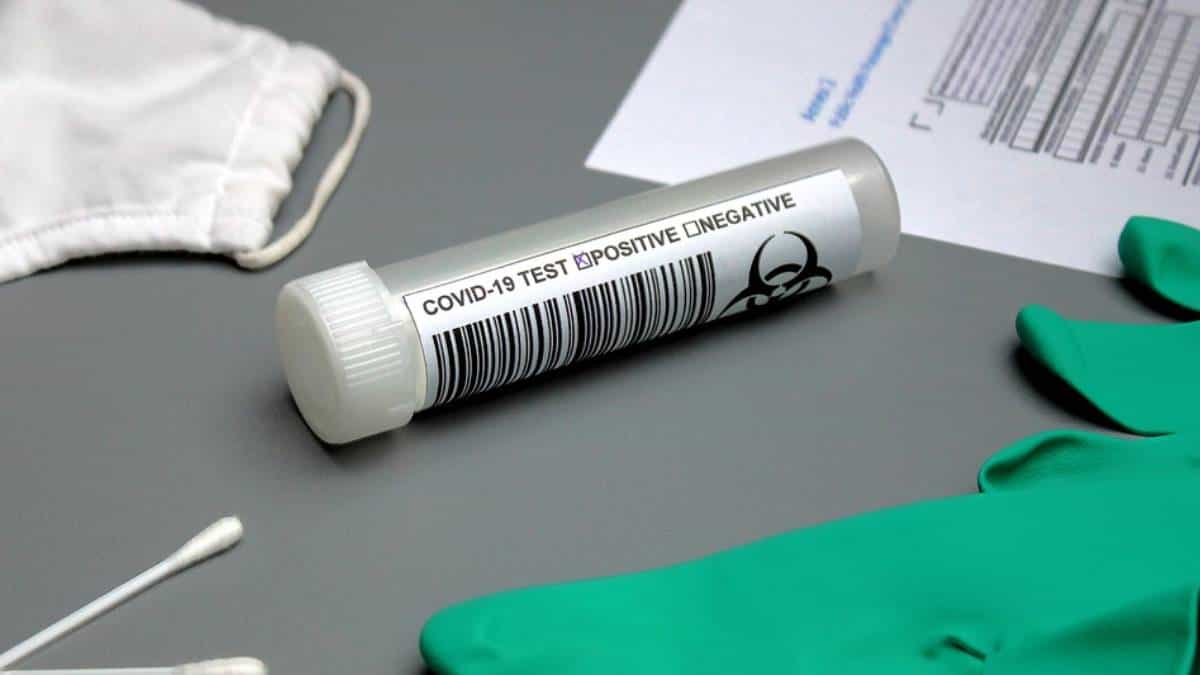 Toma de pruebas covid 19 gratuitas este 9 de noviembre en Bogotá