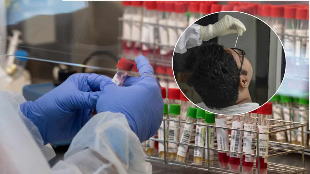 Dónde tomarse pruebas covid gratis este jueves 17 de junio en Bogotá