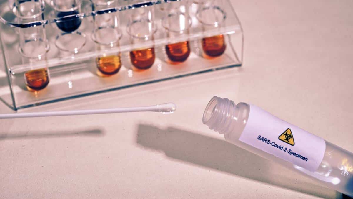 Alemania donó a Colombia 500.000 pruebas PCR para detectar covid