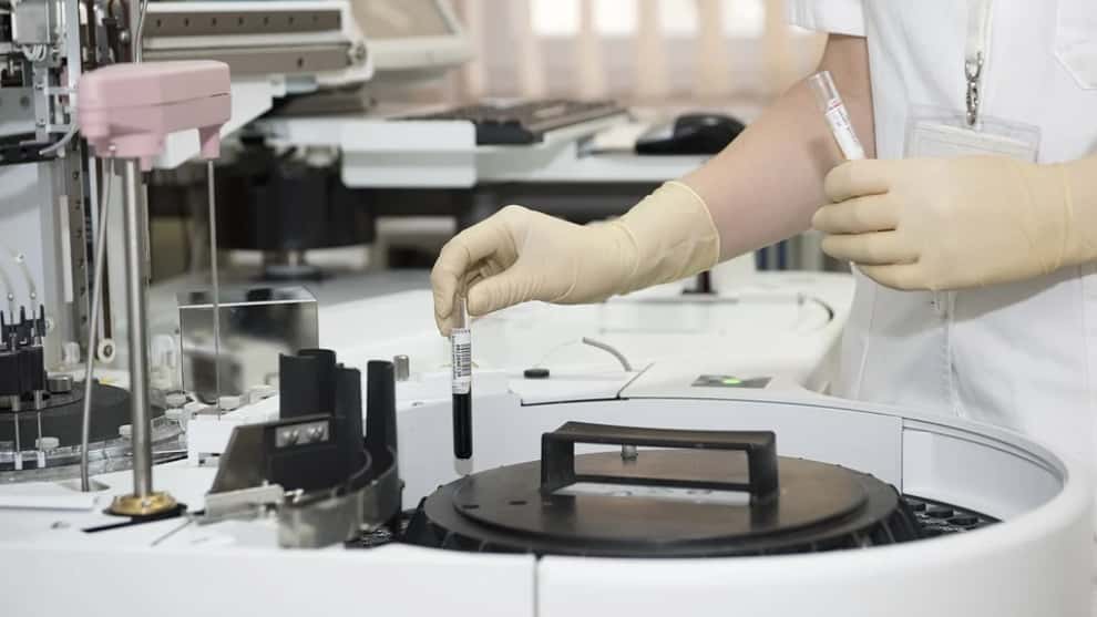 Estos son los lugares el país en donde podrá realizase la prueba del coronavirus