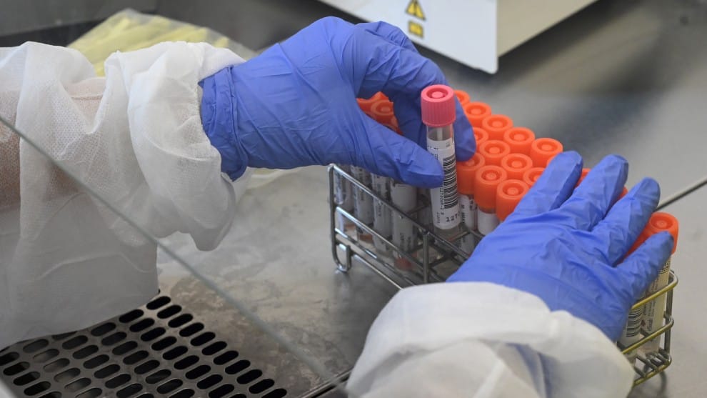 Viceministro de Salud habla sobre las pruebas de coronavirus en Colombia
