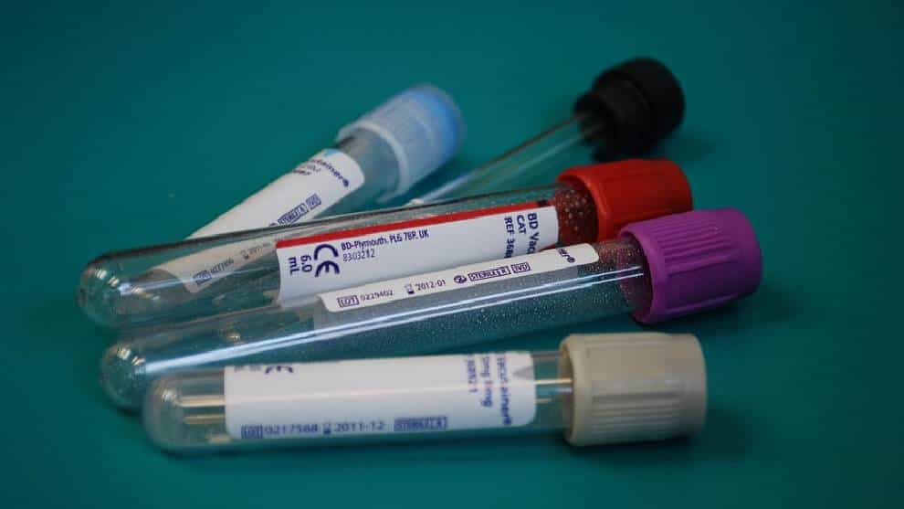 Invima denuncias fallas en un lote de prueba rápidas