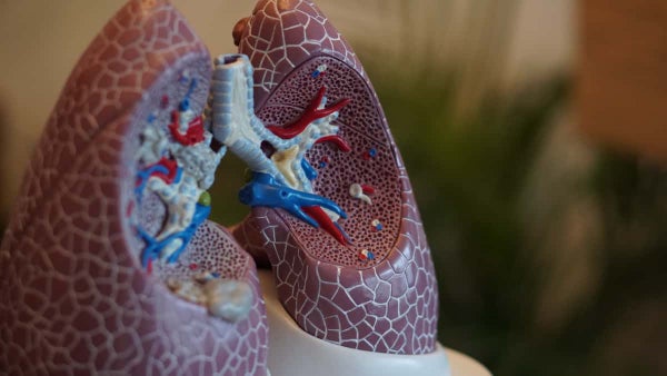 Estudio reveló que la marihuana daña más los pulmones que el tabaco