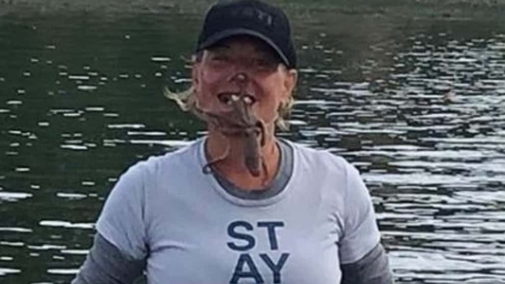 Mujer termina con parálisis facial por tomarse una foto con un pulpo