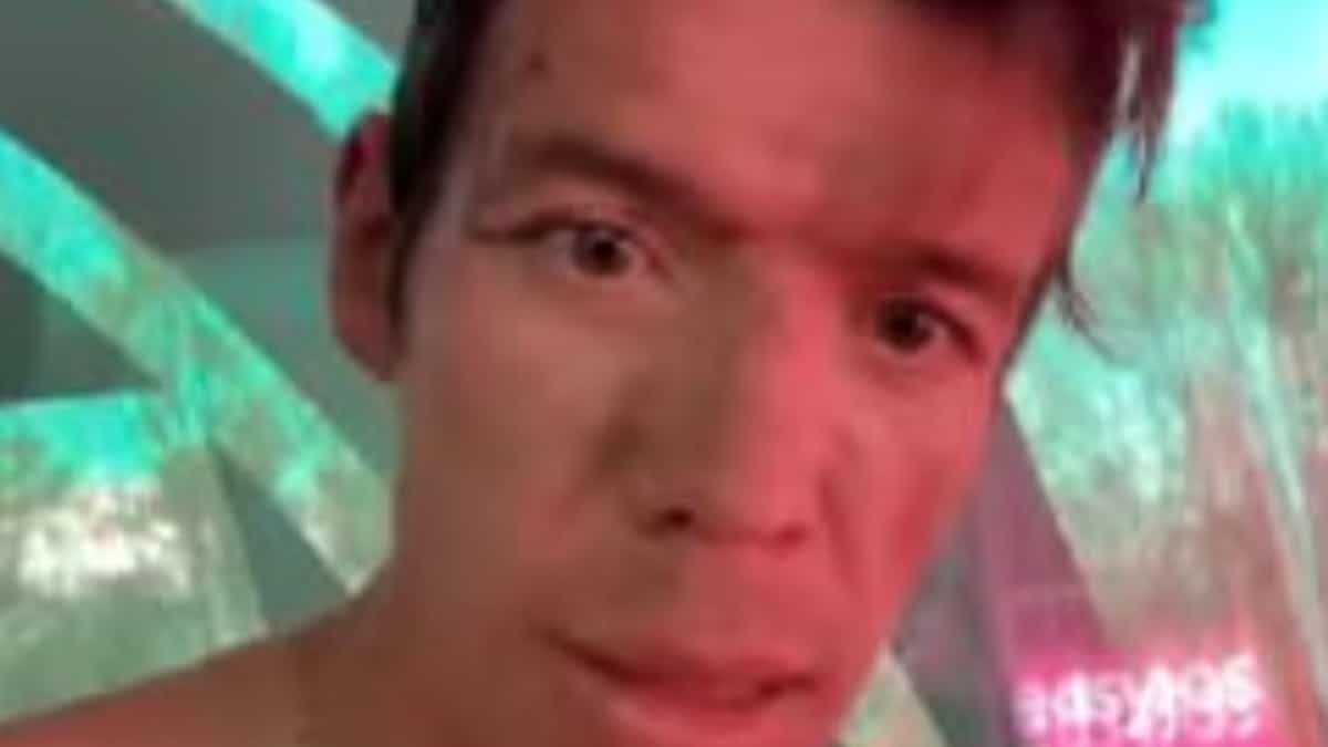 Rigoberto Urán heridas tras caída en la Lieja-Bastoña-Lieja